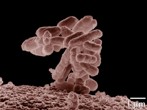 Escherichia coli